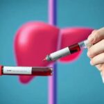 Entenda o AST Teste: O que revela sobre sua saúde hepática?