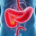 Câncer de pâncreas: sintomas, causas e tratamentos da doença que afetou Edu Guedes