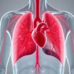 Entenda o que é o aumento do fluxo sanguíneo pulmonar e suas causas