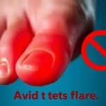 Gota: Causas, Sintomas e Tratamento para Aliviar as Crises