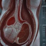 O que você precisa saber sobre a insuficiência placentária na gravidez