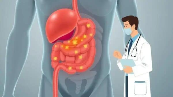 Gastrite Crônica: causas, sintomas e tratamento para aliviar o desconforto